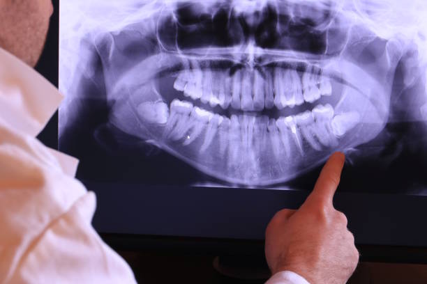 Best Emergency Dental Extractions in Waynesboro, MS